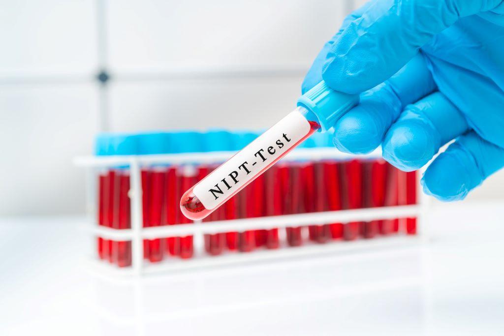 出生前検査　出生前診断　NIPT　無認証NIPT